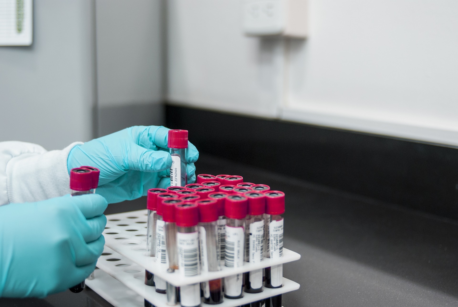 HbA1C & variações glicêmicas: a teoria do livro.