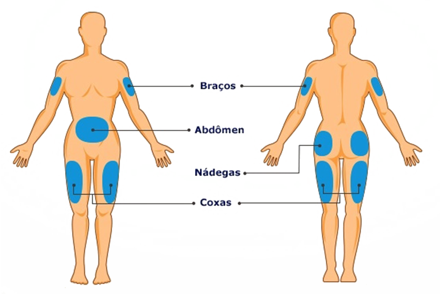 Gliconline Diabetes - Locais de Aplicação de Insulina