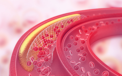 Diabetes tipo 2: por que é importante acompanhar a taxa de colesterol?