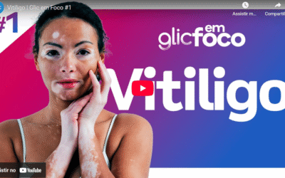 Vitiligo | Glic em Foco #1