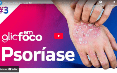 Psoríase | Glic em Foco #3